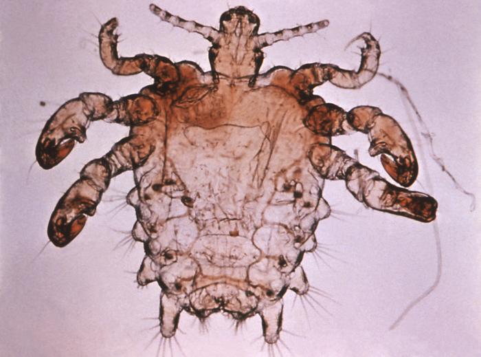 Fladlus Symptomer, behandling, forebyggelse osv.