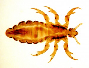 Head lice are whitish, brownish or grayish in color - but after blood consumption they can turn reddish