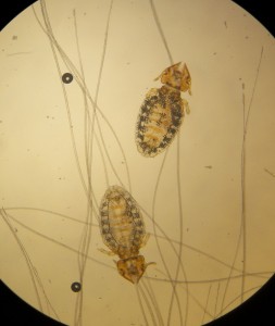 Cat lice are biting lice that only attach themselves to cats