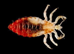 Body lice look very similar to head lice
